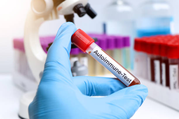 Sakit Autoimun Ketika Sistem Kekebalan Tubuh Menyerang Diri Sendiri